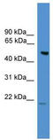 Flagellum Associated Containing Coiled-Coil Domains 1 antibody, TA340324, Origene, Western Blot image 