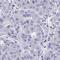 Cilia And Flagella Associated Protein 69 antibody, HPA062883, Atlas Antibodies, Immunohistochemistry paraffin image 