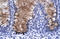 Annexin A1 antibody, ARP36568_T100, Aviva Systems Biology, Immunohistochemistry paraffin image 