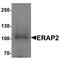 Endoplasmic reticulum aminopeptidase 2 antibody, TA326651, Origene, Western Blot image 