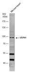 Ventricular zone-expressed PH domain-containing protein 1 antibody, PA5-36006, Invitrogen Antibodies, Western Blot image 