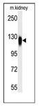 Histone Deacetylase 6 antibody, AP11132PU-N, Origene, Western Blot image 