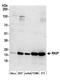HCNP antibody, A304-493A, Bethyl Labs, Western Blot image 