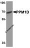 Protein Phosphatase, Mg2+/Mn2+ Dependent 1D antibody, 8043, ProSci, Western Blot image 