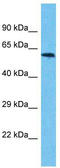 Ubiquitin Specific Peptidase 17 Like Family Member 3 antibody, TA330815, Origene, Western Blot image 