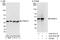 Proteasome 26S Subunit, Non-ATPase 13 antibody, A303-832A, Bethyl Labs, Western Blot image 