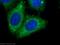 Ribonucleotide Reductase Catalytic Subunit M1 antibody, 60073-2-Ig, Proteintech Group, Immunofluorescence image 