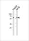 Ubiquitin Specific Peptidase 22 antibody, LS-C99567, Lifespan Biosciences, Western Blot image 