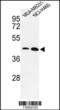 Krueppel-like factor 4 antibody, TA324725, Origene, Western Blot image 