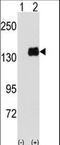 Pumilio homolog 1 antibody, LS-C100194, Lifespan Biosciences, Western Blot image 