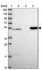 DENN Domain Containing 2D antibody, NBP2-30448, Novus Biologicals, Western Blot image 