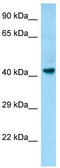 Probable G-protein coupled receptor 34 antibody, TA338155, Origene, Western Blot image 