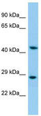 Keratin 35 antibody, TA334318, Origene, Western Blot image 