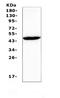 Gap Junction Protein Gamma 1 antibody, A08562, Boster Biological Technology, Western Blot image 