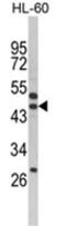 SERPINB7 antibody, AP18192PU-N, Origene, Western Blot image 