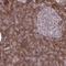 Stromal Interaction Molecule 2 antibody, HPA057511, Atlas Antibodies, Immunohistochemistry paraffin image 