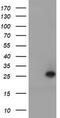Ubiquitin Conjugating Enzyme E2 E3 antibody, CF504671, Origene, Western Blot image 