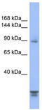 Serine/threonine-protein phosphatase 2A regulatory subunit B subunit alpha antibody, TA337691, Origene, Western Blot image 