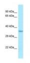 IMP U3 Small Nucleolar Ribonucleoprotein 4 antibody, NBP1-98503, Novus Biologicals, Western Blot image 