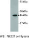 Forkhead Box D3 antibody, MBS355177, MyBioSource, Western Blot image 