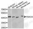 F-Box Protein 4 antibody, A9968, ABclonal Technology, Western Blot image 