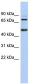 Zinc Finger And BTB Domain Containing 26 antibody, TA345307, Origene, Western Blot image 