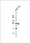 Mel antibody, PA5-72605, Invitrogen Antibodies, Western Blot image 