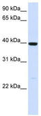 Alcohol Dehydrogenase 1A (Class I), Alpha Polypeptide antibody, TA346211, Origene, Western Blot image 