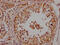 Nerve Growth Factor antibody, CSB-RA288635A0HU, Cusabio, Immunohistochemistry paraffin image 