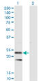 Signal Sequence Receptor Subunit 2 antibody, LS-C198266, Lifespan Biosciences, Western Blot image 