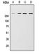 Mechanistic Target Of Rapamycin Kinase antibody, LS-C352226, Lifespan Biosciences, Western Blot image 