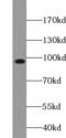 Mineralocorticoid receptor antibody, FNab05846, FineTest, Western Blot image 