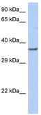 TFDP1 antibody, TA330110, Origene, Western Blot image 