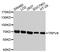 Transient Receptor Potential Cation Channel Subfamily V Member 6 antibody, MBS127261, MyBioSource, Western Blot image 