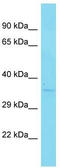 Dehydrogenase/Reductase 7C antibody, TA335909, Origene, Western Blot image 