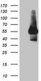 Interleukin 15 Receptor Subunit Alpha antibody, TA812231S, Origene, Western Blot image 