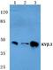 Ckbeta3 antibody, PA5-36970, Invitrogen Antibodies, Western Blot image 