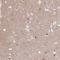 Small conductance calcium-activated potassium channel protein 3 antibody, HPA017990, Atlas Antibodies, Immunohistochemistry frozen image 