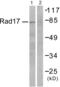 Abhydrolase Domain Containing 14A antibody, abx014136, Abbexa, Western Blot image 