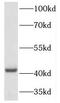 Homeobox protein Hox-A2 antibody, FNab03974, FineTest, Western Blot image 