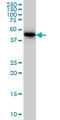 Cartilage Associated Protein antibody, LS-C105103, Lifespan Biosciences, Western Blot image 