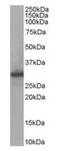Four And A Half LIM Domains 1 antibody, orb18892, Biorbyt, Western Blot image 