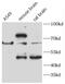 Very long-chain specific acyl-CoA dehydrogenase, mitochondrial antibody, FNab00068, FineTest, Western Blot image 