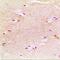Peroxisomal Biogenesis Factor 14 antibody, orb214381, Biorbyt, Immunohistochemistry paraffin image 