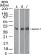 Caspase 7 antibody, TA336390, Origene, Western Blot image 
