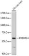 PR/SET Domain 14 antibody, 22-270, ProSci, Western Blot image 
