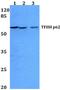 General Transcription Factor IIH Subunit 1 antibody, PA5-36246, Invitrogen Antibodies, Western Blot image 
