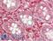 Protein Kinase N1 antibody, LS-B13584, Lifespan Biosciences, Immunohistochemistry paraffin image 
