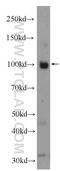 ESF1 Nucleolar Pre-RRNA Processing Protein Homolog antibody, 23496-1-AP, Proteintech Group, Western Blot image 