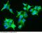 Heat shock protein beta-1 antibody, 10351-MM09, Sino Biological, Immunohistochemistry paraffin image 